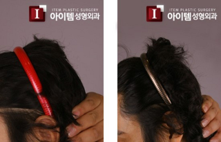 Illustration for article titled "Round Head" Plastic Surgery Seems Excessive, Even for South Korea